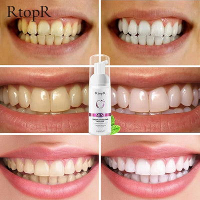Tooth Whitening Mousse.